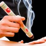 Moxibustion
